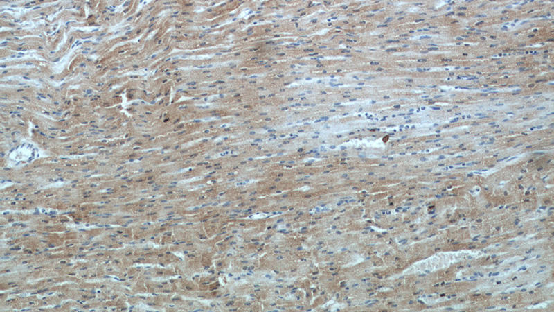 Immunohistochemical of paraffin-embedded human heart using Catalog No:115407(SMYD2 antibody) at dilution of 1:100 (under 10x lens)