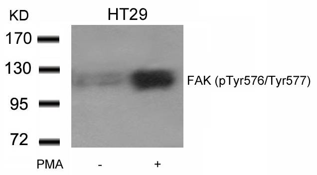 Western blot analysis of extracts from HT29 cells untreated or treated with PMA using FAK (phospho-Tyr576/Tyr577) Antibody .
