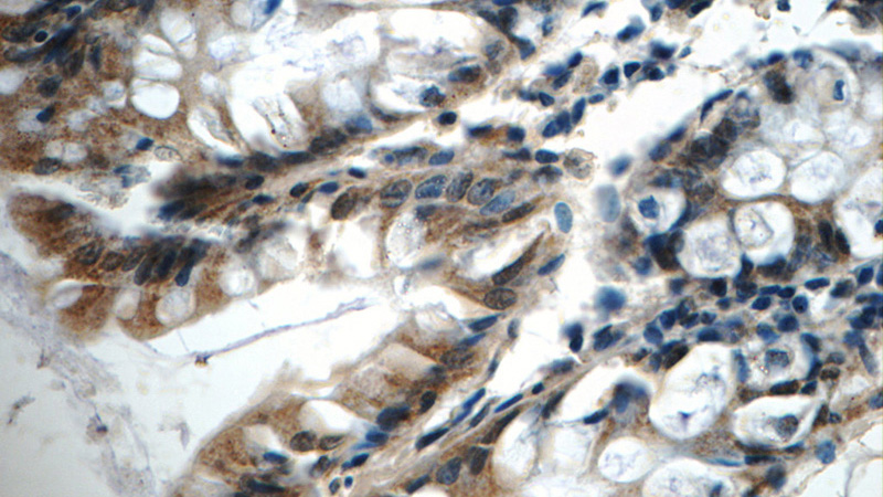 Immunohistochemistry of paraffin-embedded human colon tissue slide using Catalog No:113438(OSGEPL1 Antibody) at dilution of 1:50 (under 40x lens)