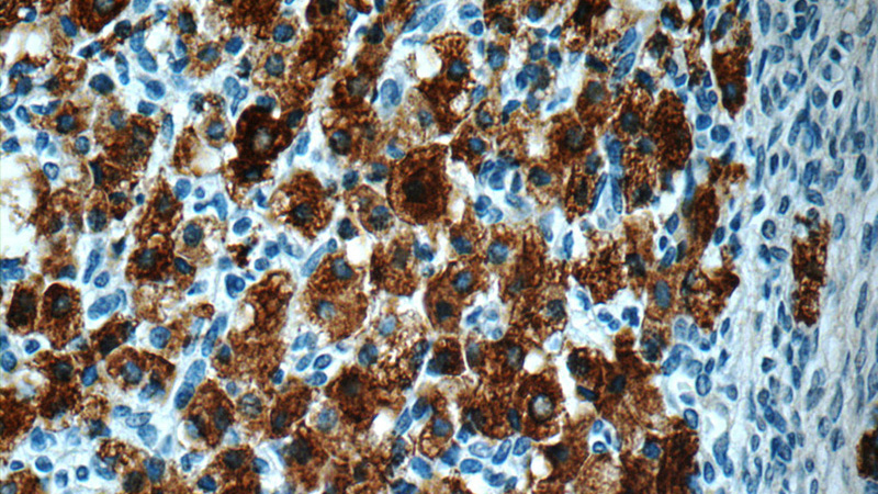 Immunohistochemistry of paraffin-embedded human ovary slide using Catalog No:108732(C4orf49 Antibody) at dilution of 1:50