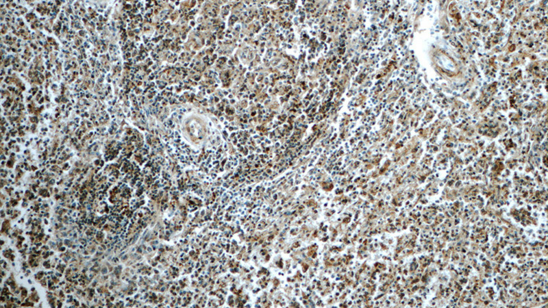 Immunohistochemistry of paraffin-embedded human spleen tissue slide using Catalog No:115761(SYK Antibody) at dilution of 1:50 (under 10x lens)