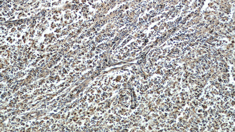 Immunohistochemical of paraffin-embedded human spleen using Catalog No:109074(CCR10 antibody) at dilution of 1:50 (under 10x lens)