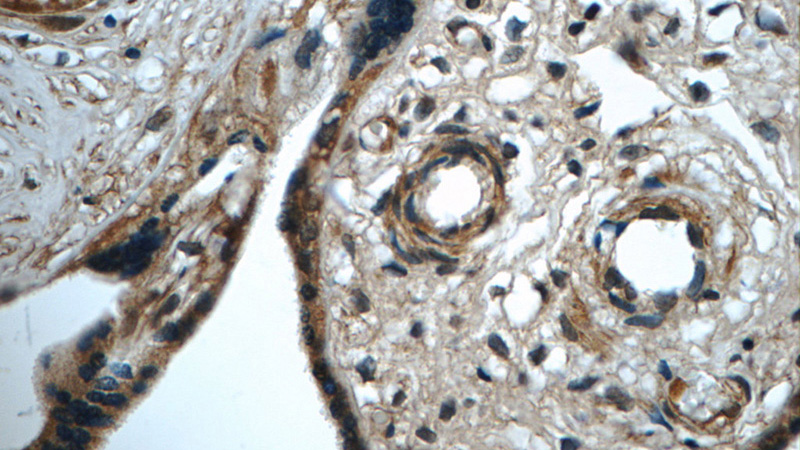 Immunohistochemistry of paraffin-embedded human placenta tissue slide using Catalog No:107395(IL27 Antibody) at dilution of 1:50 (under 40x lens)