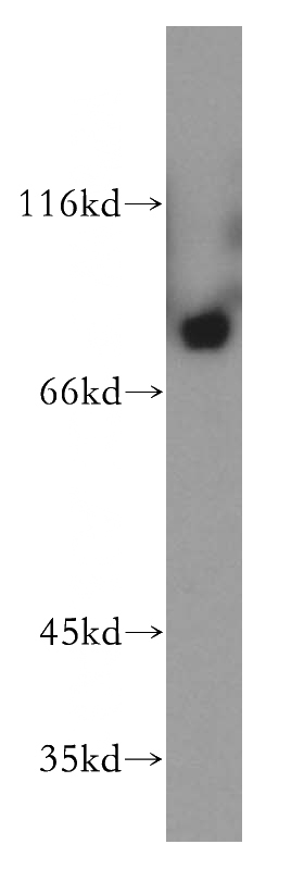 mouse brain tissue were subjected to SDS PAGE followed by western blot with Catalog No:113172(NGEF antibody) at dilution of 1:500