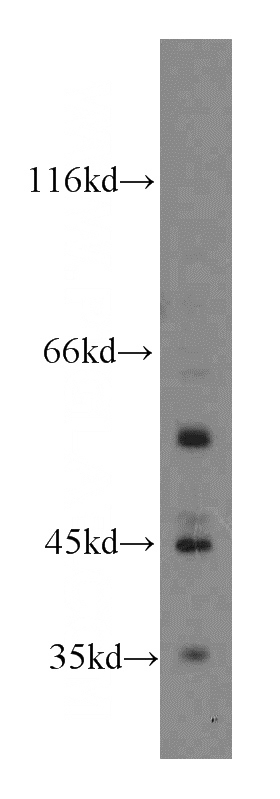 COLO 320 cells were subjected to SDS PAGE followed by western blot with Catalog No:113441(OSR1 antibody) at dilution of 1:600