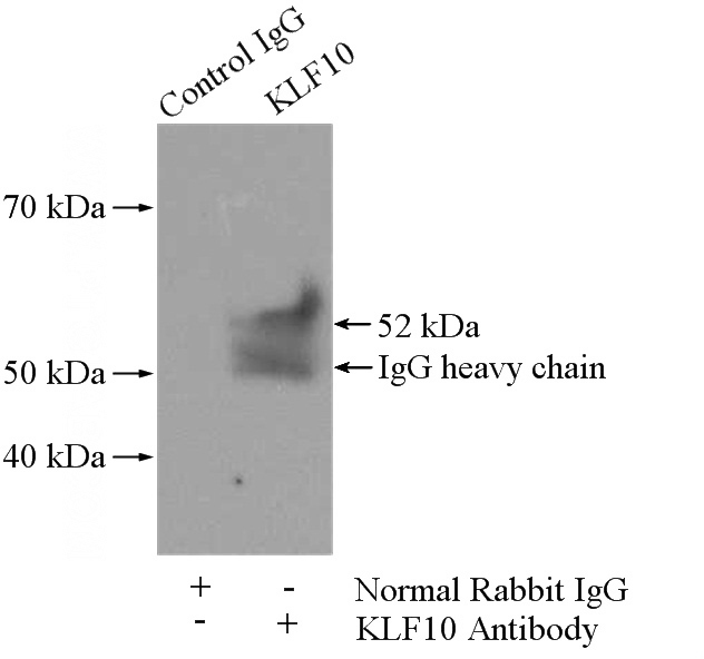 IP Result of anti-KLF10 (IP:Catalog No:112076, 4ug; Detection:Catalog No:112076 1:300) with Jurkat cells lysate 2800ug.