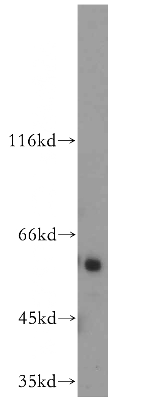 Jurkat cells were subjected to SDS PAGE followed by western blot with Catalog No:110278(ELK1 antibody) at dilution of 1:800