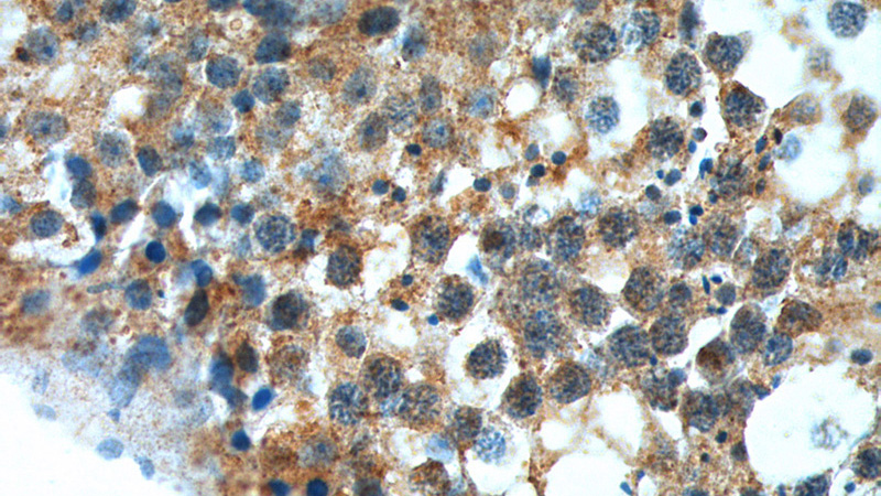 Immunohistochemistry of paraffin-embedded human testis tissue slide using Catalog No:111124(GPR22 Antibody) at dilution of 1:100 (under 40x lens).