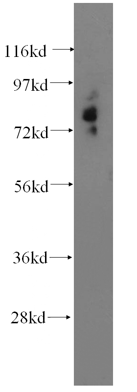 A375 cells were subjected to SDS PAGE followed by western blot with Catalog No:112893(MCOLN3 antibody) at dilution of 1:400