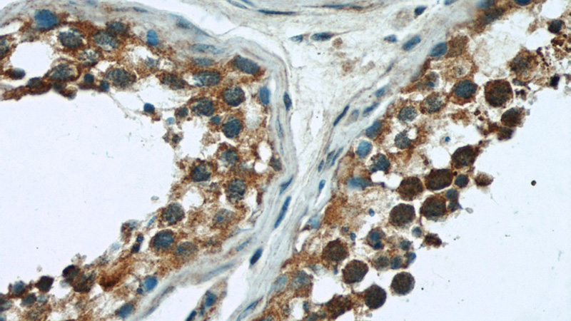 Immunohistochemical of paraffin-embedded human testis using Catalog No:114445(RAB3GAP1 antibody) at dilution of 1:100 (under 40x lens)
