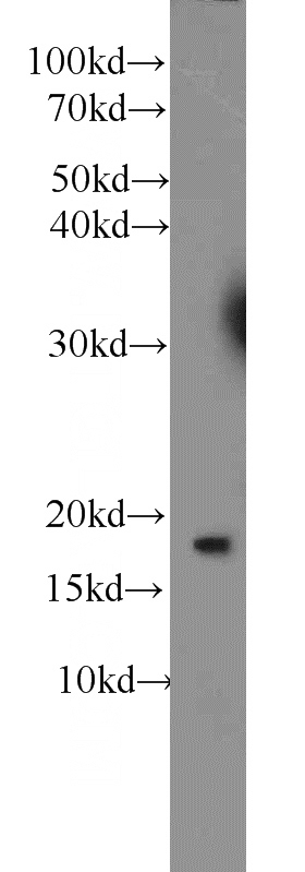 Jurkat cells were subjected to SDS PAGE followed by western blot with Catalog No:114836(RPS25 antibody) at dilution of 1:1000