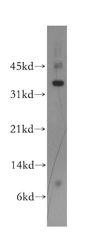 SH-SY5Y cells were subjected to SDS PAGE followed by western blot with Catalog No:110638(FGFBP2 antibody) at dilution of 1:400