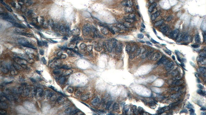 Immunohistochemistry of paraffin-embedded human colon tissue slide using Catalog No:109219(CHD3 Antibody) at dilution of 1:50 (under 40x lens)