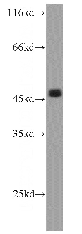 HEK-293 cells were subjected to SDS PAGE followed by western blot with Catalog No:113804(EGLN1 antibody) at dilution of 1:800