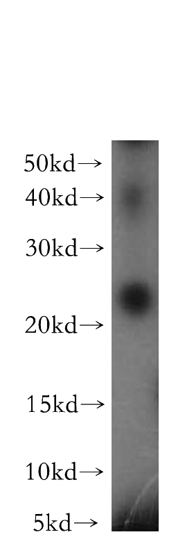 HeLa cells were subjected to SDS PAGE followed by western blot with Catalog No:114383(PSMB3 antibody) at dilution of 1:200