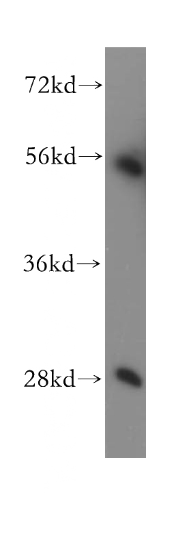HEK-293 cells were subjected to SDS PAGE followed by western blot with Catalog No:115752(SUV39H2 antibody) at dilution of 1:300