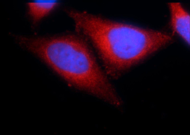 Immunofluorescent analysis of L02 cells using Catalog No:108854(CARD11 Antibody) at dilution of 1:25 and Rhodamine-Goat anti-Rabbit IgG