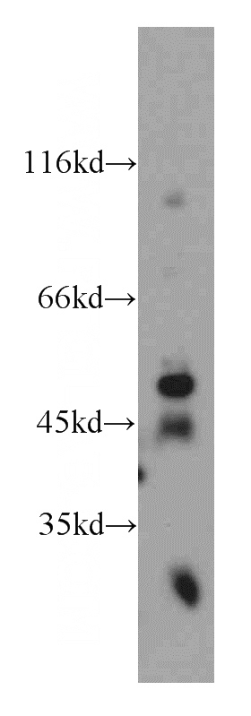 mouse brain tissue were subjected to SDS PAGE followed by western blot with Catalog No:116828(WIPF2 antibody) at dilution of 1:500