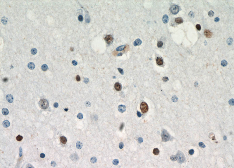 Immunohistochemical of paraffin-embedded human brain using Catalog No:117184(ZNF488 antibody) at dilution of 1:50 (under 40x lens)