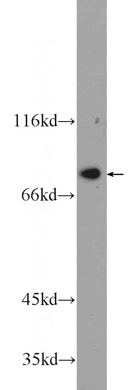 K-562 cells were subjected to SDS PAGE followed by western blot with Catalog No:116919(ZBTB48 Antibody) at dilution of 1:600