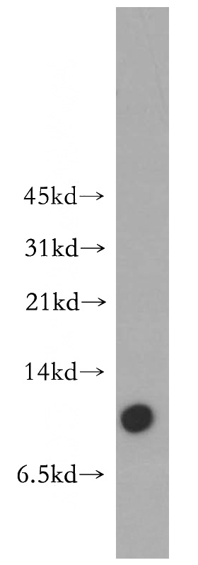 mouse brain tissue were subjected to SDS PAGE followed by western blot with Catalog No:112723(MOBP antibody) at dilution of 1:500