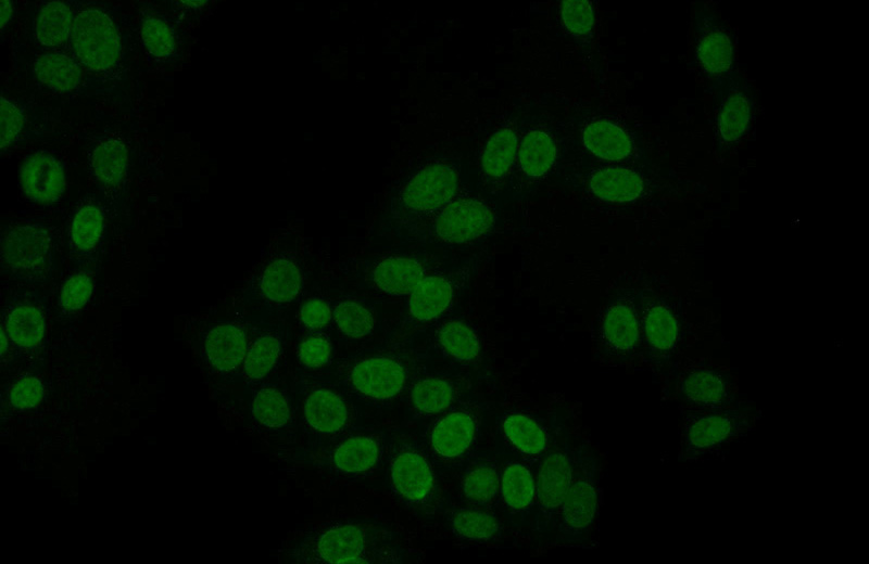 Immunofluorescent analysis of HepG2 cells using Catalog No:115002(SCML1 Antibody) at dilution of 1:25 and Alexa Fluor 488-congugated AffiniPure Goat Anti-Rabbit IgG(H+L)