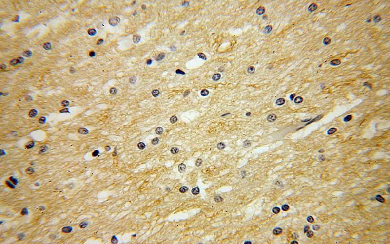 Immunohistochemical of paraffin-embedded human brain using Catalog No:110965(GHITM antibody) at dilution of 1:50 (under 40x lens)
