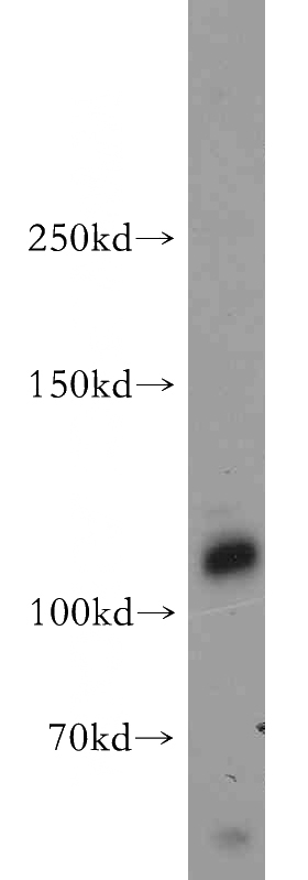 MCF7 cells were subjected to SDS PAGE followed by western blot with Catalog No:115283(SHROOM1 antibody) at dilution of 1:500