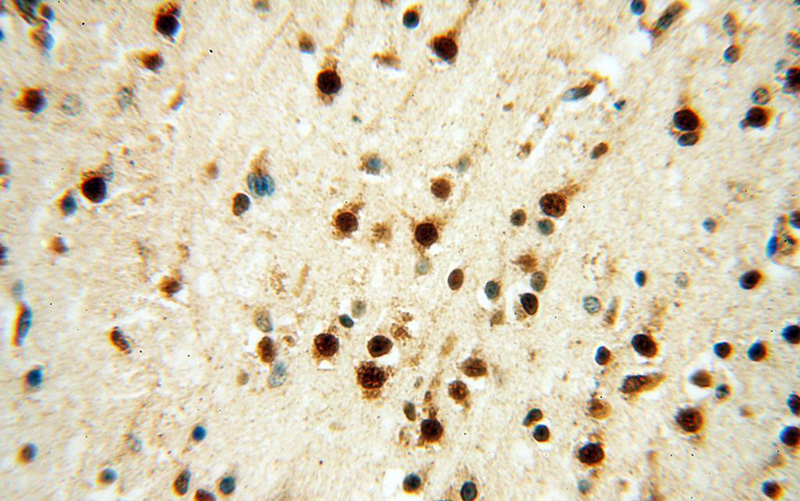 Immunohistochemical of paraffin-embedded human brain using Catalog No:112147(LARP4 antibody) at dilution of 1:50 (under 40x lens)