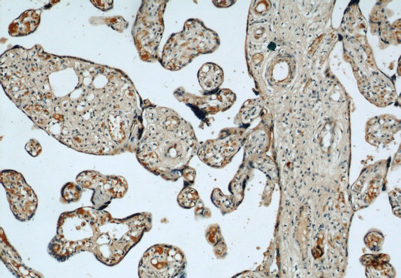 Immunohistochemical of paraffin-embedded human placenta using Catalog No:110248(ENG antibody) at dilution of 1:50 (under 10x lens)