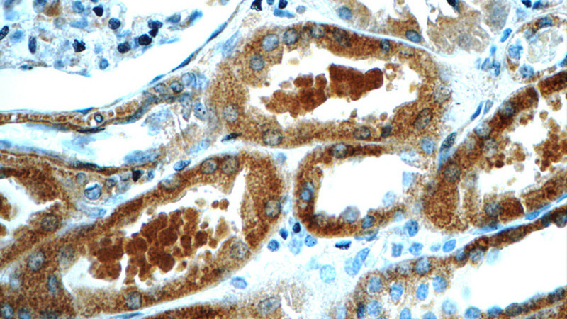 Immunohistochemistry of paraffin-embedded human kidney tissue slide using Catalog No:114984(SCAP Antibody) at dilution of 1:50 (under 40x lens)