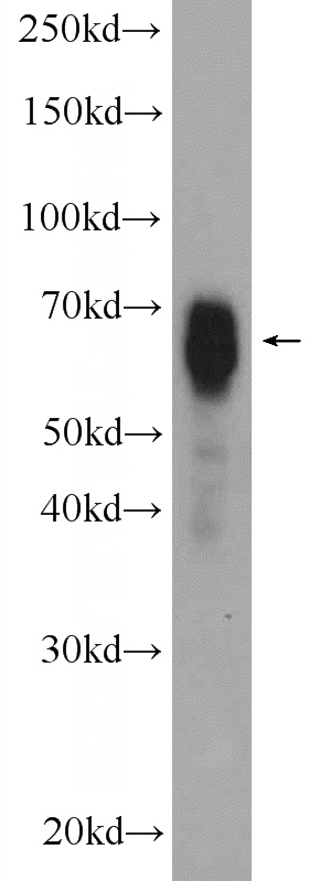 mouse brain tissue were subjected to SDS PAGE followed by western blot with Catalog No:113372(NUMBLIKE Antibody) at dilution of 1:2000