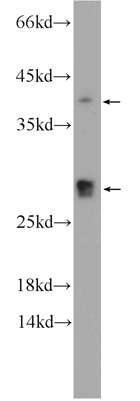 MCF-7 cells were subjected to SDS PAGE followed by western blot with Catalog No:109256(CENPN Antibody) at dilution of 1:1000