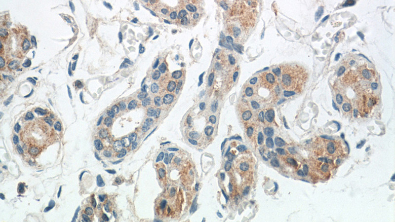 Immunohistochemistry of paraffin-embedded human skin tissue slide using Catalog No:116031(TGM5 Antibody) at dilution of 1:50 (under 40x lens)