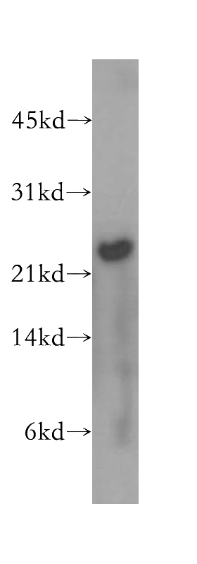 human brain tissue were subjected to SDS PAGE followed by western blot with Catalog No:112369(MAD2L2 antibody) at dilution of 1:500