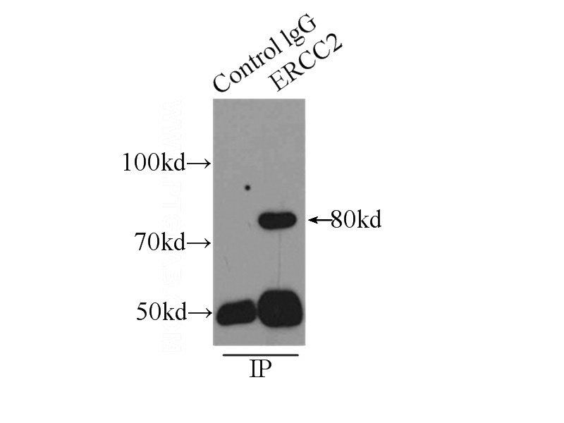 IP Result of anti-ERCC2 (IP:Catalog No:110408, 5ug; Detection:Catalog No:110408 1:500) with K-562 cells lysate 8000ug.