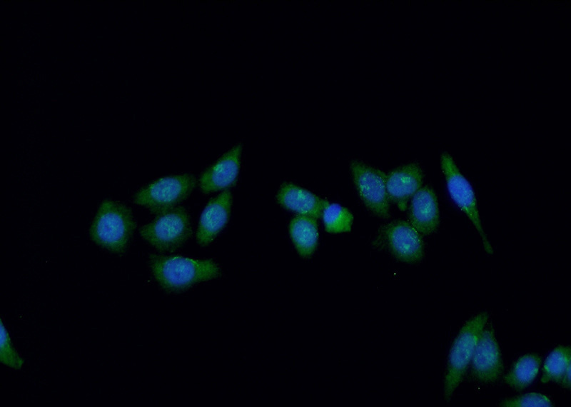 Immunofluorescent analysis of HeLa cells using Catalog No:116992(ERCC5 Antibody) at dilution of 1:50 and Alexa Fluor 488-congugated AffiniPure Goat Anti-Rabbit IgG(H+L)