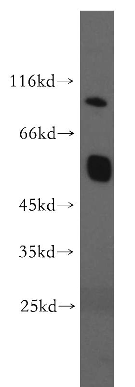 human brain tissue were subjected to SDS PAGE followed by western blot with Catalog No:112600(GRM1 antibody) at dilution of 1:300