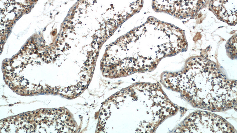 Immunohistochemistry of paraffin-embedded human testis tissue slide using Catalog No:115003(SCML2 Antibody) at dilution of 1:50 (under 10x lens)