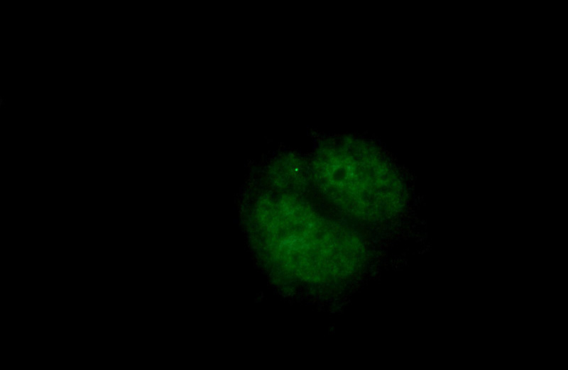 Immunofluorescent analysis of Neuro-2a cells using Catalog No:113862(PHOX2B Antibody) at dilution of 1:25 and Alexa Fluor 488-congugated AffiniPure Goat Anti-Rabbit IgG(H+L)