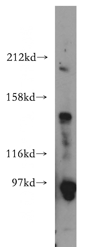 HEK-293 cells were subjected to SDS PAGE followed by western blot with Catalog No:113025(N-cadherin antibody) at dilution of 1:500