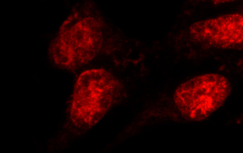 Immunofluorescent analysis of HEK-293 cells using Catalog No:112567(MDC1 Antibody) at dilution of 1:25 and Rhodamine-Goat anti-Rabbit IgG