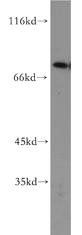 A431 cells were subjected to SDS PAGE followed by western blot with Catalog No:115257(SKIL antibody) at dilution of 1:300