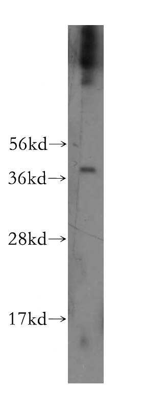 human heart tissue were subjected to SDS PAGE followed by western blot with Catalog No:116538(UBE2U antibody) at dilution of 1:500