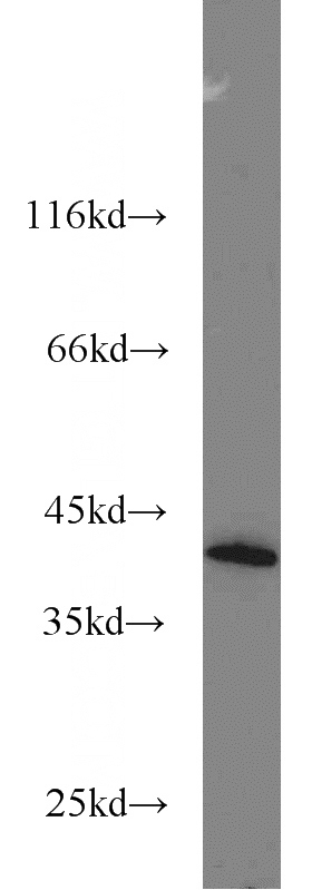 HeLa cells were subjected to SDS PAGE followed by western blot with Catalog No:109860(DAP3 antibody) at dilution of 1:1000