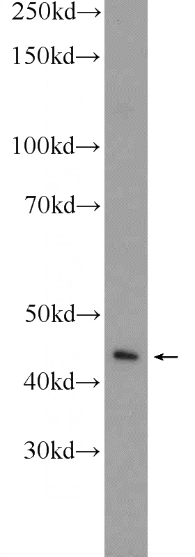 HeLa cells were subjected to SDS PAGE followed by western blot with Catalog No:115971(TACR2 Antibody) at dilution of 1:600