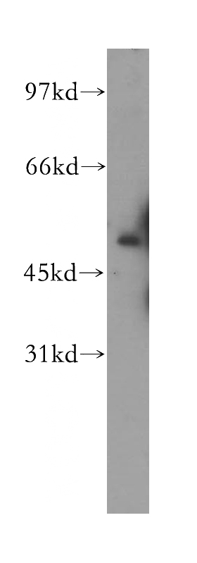 human liver tissue were subjected to SDS PAGE followed by western blot with Catalog No:107691(ACP6 antibody) at dilution of 1:300