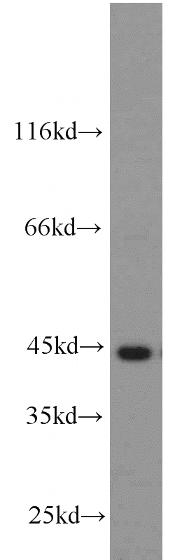 mouse liver tissue were subjected to SDS PAGE followed by western blot with Catalog No:107720(ACADM antibody) at dilution of 1:500