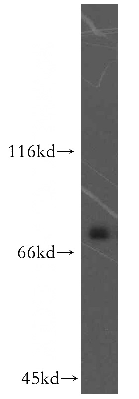 HeLa cells were subjected to SDS PAGE followed by western blot with Catalog No:111916(KATNB1 antibody) at dilution of 1:300