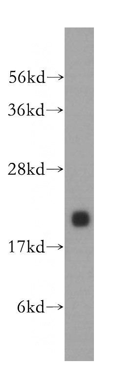human heart tissue were subjected to SDS PAGE followed by western blot with Catalog No:107868(CRYAB antibody) at dilution of 1:500